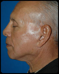 Face and Neck Surgery 