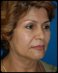 Face and Neck Surgery 