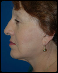 Face and Neck Surgery 