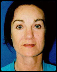 Face and Neck Surgery 